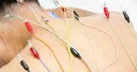 Maxi Electro Acupuncture Device