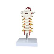 Spine Neck Model Model 21